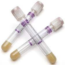 TUBO PARA EXTRACCION DE SANGRE TAPA BLANCA PERLA BECTON DICKINSON PPT CON EDTA K2 / 5ML / CAJA 100 UNIDADES