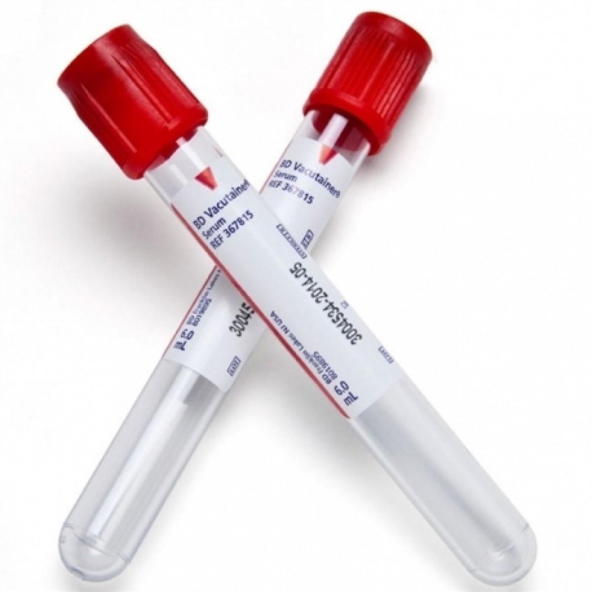 TUBO PARA EXTRACCION DE SANGRE TAPA ROJA BECTON DICKINSON / 4ML / CAJA 100 UNIDADES