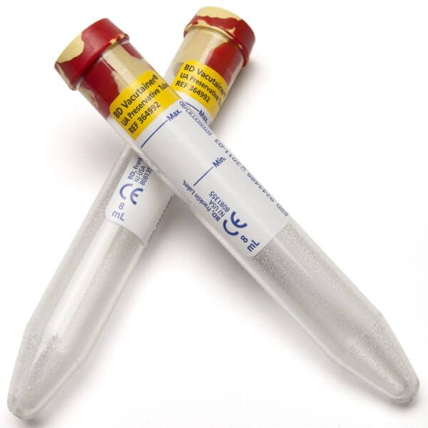 TUBO PARA RECOLECCION Y PRESERVACIÓN DE MUESTRAS DE ORINA CON PRESERVANTE BECTON DICKINSON / 8 ML / CAJA 100 UNIDADES